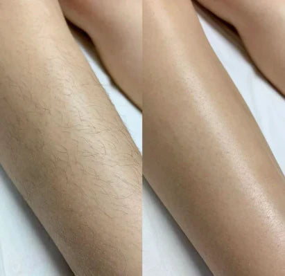 Afeitadora Eléctrica Multifuncional para Mujer- Lady Shaver